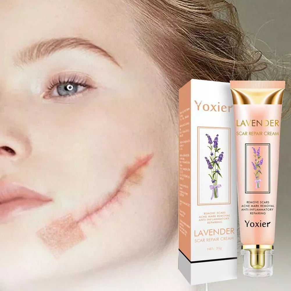 Yoxier-Crème réparatrice de cicatrices à la µ, élimination des cicatrices d'acné, élimination des marques, soin des cicatrices, lisse, commissionné, blanchiment de la peau, Pigmenta Q4L8 -